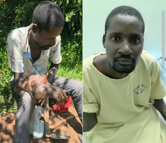 “The Arm That Almost Took His Life — And the Miracle That Saved Him” The story of Paul from Bungoma.